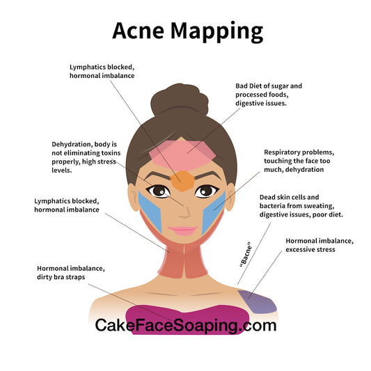 face mapping for acne
